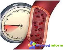 hipertenzije, brzi impuls lijekovi za liječenje hipertenzije koraka 3