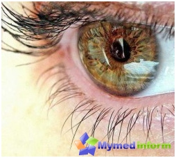 Eyes, eye diseases, vision, trachoma treatment, ophthalmology, trachoma