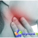 treatment-lymph-nodes