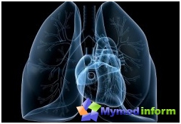 malattia, infiammazione polmonare, polmoni, mancanza di respiro, polmonite