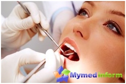 Stuzzicadenti, denti, trattamento dei denti, pulpite, odontoiatria