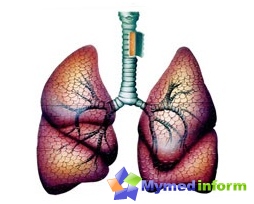 bronchial-asthma