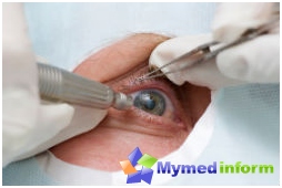 Симптоми и лечение на катаракта