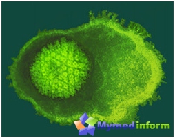 Caudente della varicella: Virice-Zoster Virus Virus