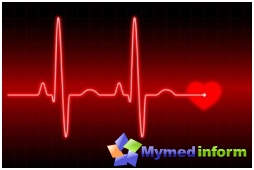 Hjertesykdommer, IBS, iskemisk hjertesykdom, iskemi, kardiologi, hjerte