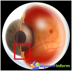 Glaucoma is a disease of the eye for which it is characterized by a periodic or constant increase in intraocular pressure