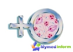 تشخيص trichomoniasis