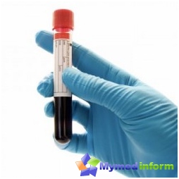 DVS-syndroom, bloed, bloedcoagulatie, trombus
