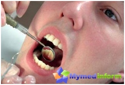 التهاب، اللثة، الناسور، طب الأسنان