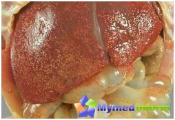 Fat, adhesive hepatosis, liver cleaning, liver