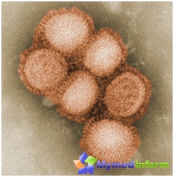 А / Х1Н1 вирус под електронским микроскопом