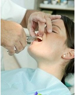 how-recognize-periodontal-disease