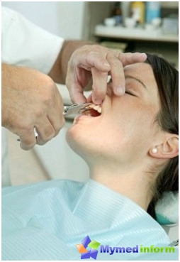 зъби, пародонтоза, устна кухина, стоматология, стоматологични грижи