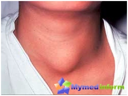 Thyroid gland plays one of the leading roles in the health of women