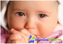 Dacryocystitis, kinderziekten, impassabiliteit van het lacrimale kanaal, pasgeboren, scheurklieren, tranen