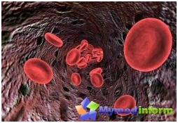 vérszegénység, betegség, hemoglobin, vashiány, vér, hemoglobin szabványok