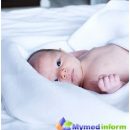 intertrigo-newborn