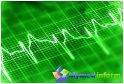 Treatment of arrhythmia