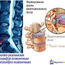 osteochondrosis