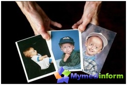 genetická onemocnění, patologie, progerie, Wernerův syndrom, Hutchinson-Guildfordův syndrom, stárnutí