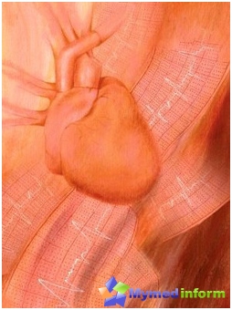 Treatment of arrhythmia