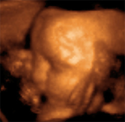 Exame de ultra-som tridimensional de 29 semanas de feto
