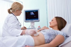 Nėštumas, gimimo data, koncepcija, ovuliacija, PDR, gimdymas, Nemela formulė