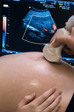Ultraschall während der Schwangerschaft