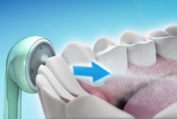 Dantys, drėkintuvai, odontologija, dantų priežiūra, dantų valymas