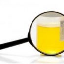 analysis-urine-nechiporenko