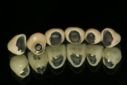 Crowns in dentistry, what better to put