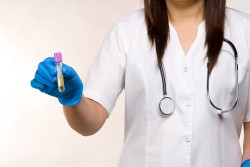 Analiza urina, ispitivanja, urina, ureter, ne županija