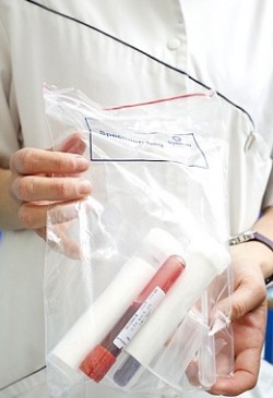 Analisi, emoglobina, sangue, analisi del sangue complessivo, consegna del sangue