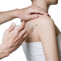 farmakopunktura