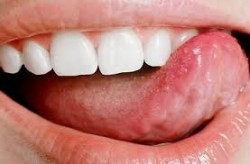 Diagnóstico em linguagem, boca, cavidade da boca, idioma