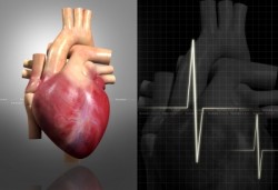 Enfermedad cardíaca isquémica, operación, corazón, derivación