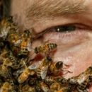 apitherapy-treatment-bees