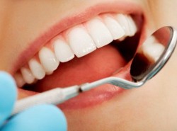 dentes, dente retentado, odontologia, remoção de dentes, cuidados com os dentes