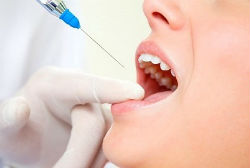 Anestesia em Odontologia