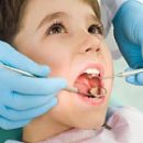 early childhood caries occurrence and flow characteristics