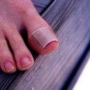 treatment of ingrown nail