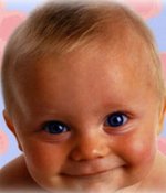 congenital cataract in children