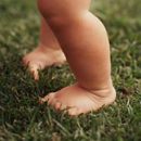 questions about the child's clubfoot