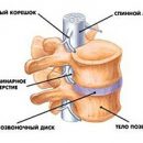 treatment of osteochondrosis