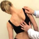scoliosis posture spoils and twists the spine