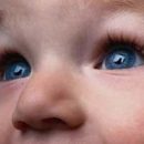 hydrocele in children: Questions and Answers