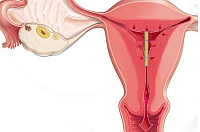 Фазе менструалних циклуса
