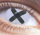 how and why developing macular degeneration