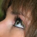 asthenopia syndrome or eye fatigue