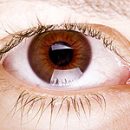 cataract causes and manifestations